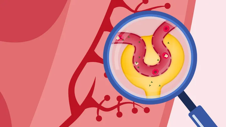 Diabetes Explainers — screenshot 3
